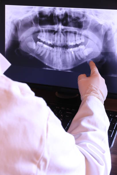 Best Emergency Dental Care for Sports Injuries in Tri Lakes, IN