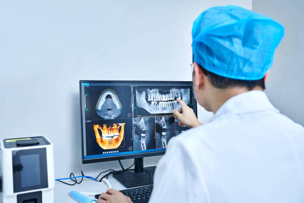 Best Emergency Wisdom Tooth Extraction in Tri Lakes, IN